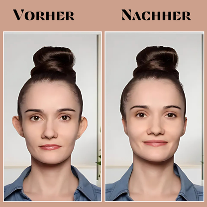 EarAlign™ - Comfortable ear molding patches