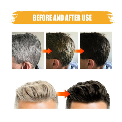 Premium Black Soap Bar Shampoo for Hair & Beard